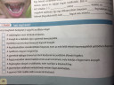 Biosz !!Kérlek segítsetek  – feladat kép 1